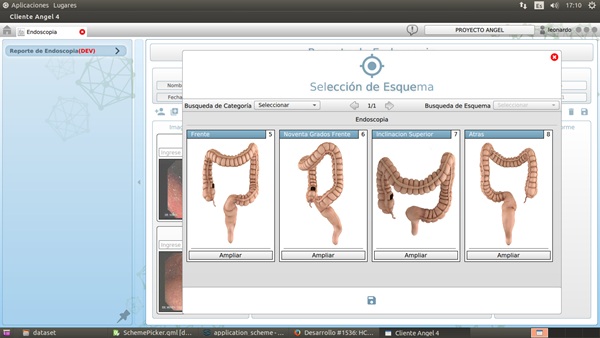 Informe endoscopía