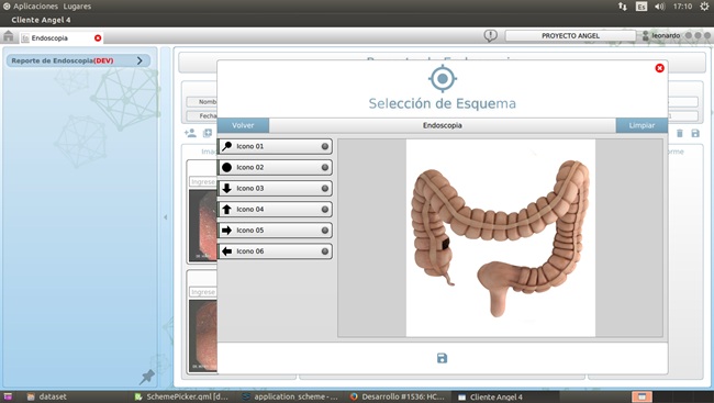 Informe endoscopía -selección esquemas