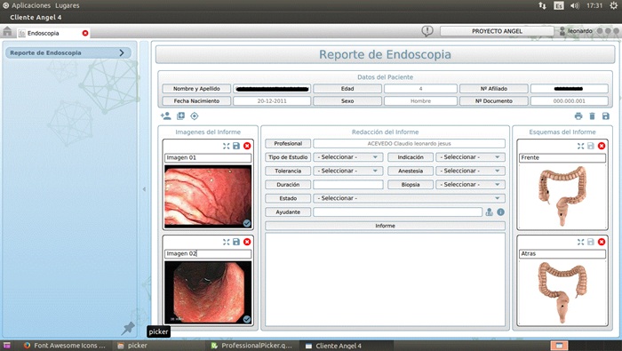 Informe endoscopía